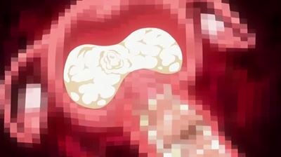 Thumbnail of post image 164
